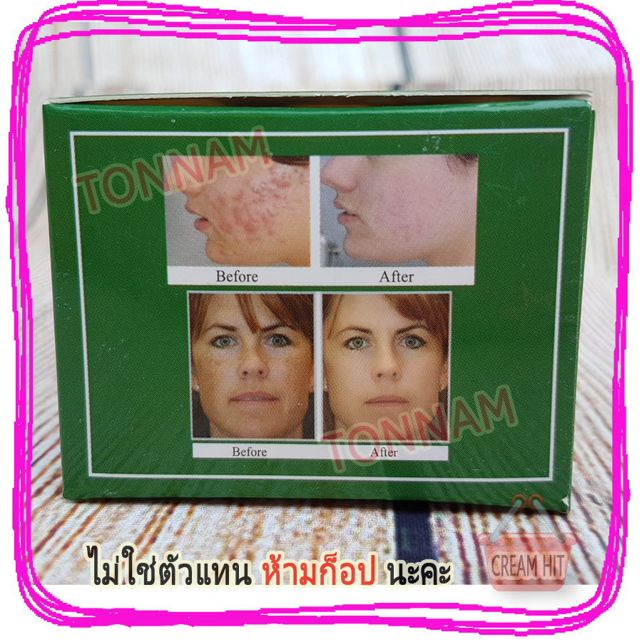 ครีมยันฮี สูตรลดฝ้าถาวร ครีมไฮยาลูรอน ยันฮีกล่องเขียว 9 กรัม+สบู่ ของแท้ ราคาส่งถูก