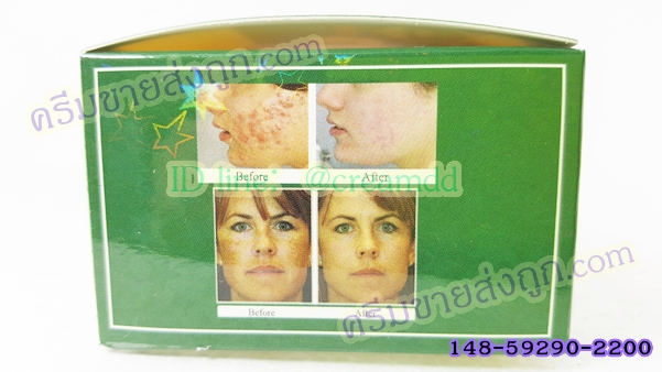 ครีมยันฮี สูตรลดฝ้าถาวร ครีมไฮยาลูรอน ผสมกลูต้า คอลลาเจน